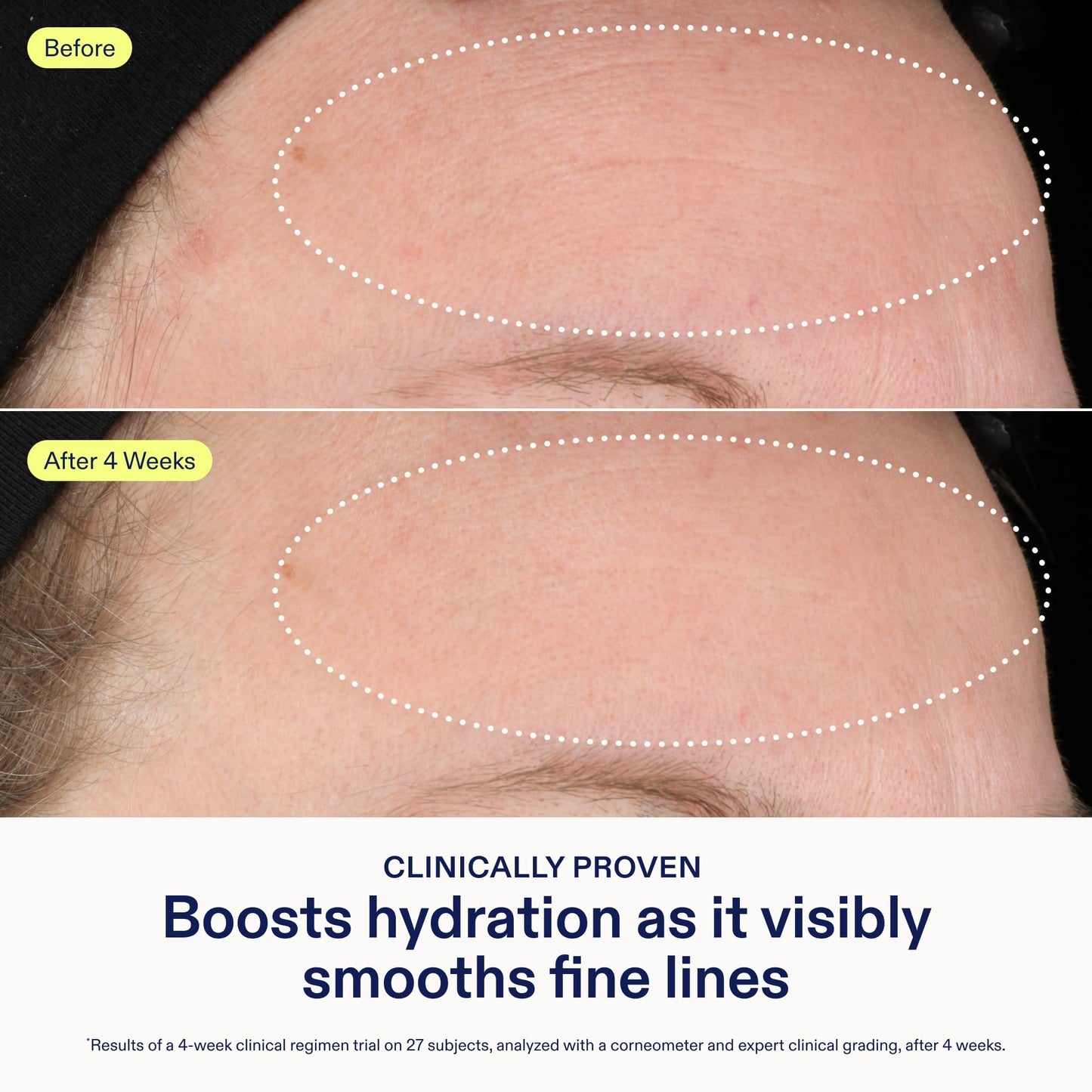 Skinfix Triple Lipid-Hyaluronate Serum - 1 oz - Hydrating Face Serum for Lasting Moisture and Radiance - Visibly Smooths Fine Lines - Non-Comedogenic - Vegan, Cruelty Free