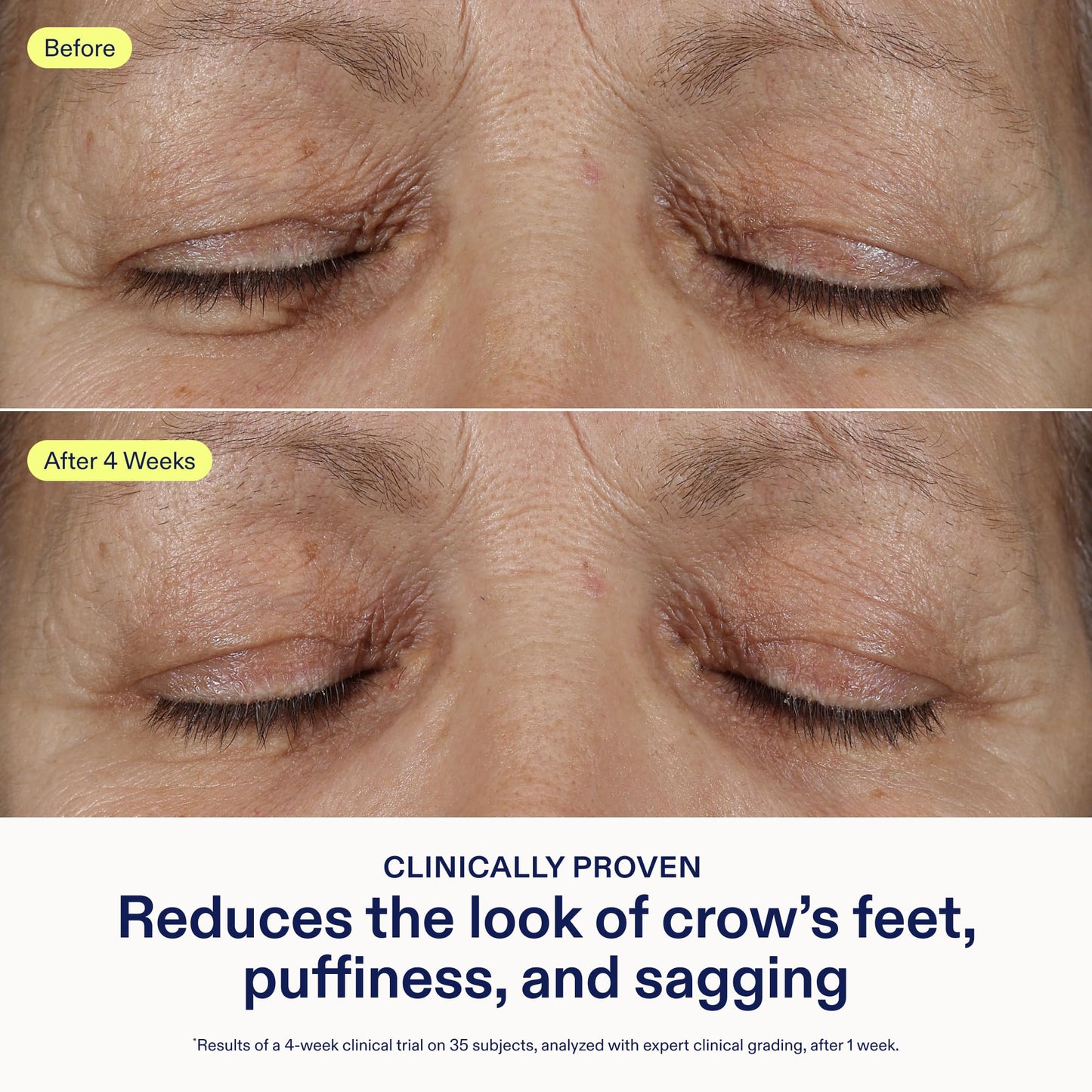 Skinfix Triple Lipid Eye Treatment - 0.5 fl oz - Eye Cream - Visibly Tightens, Depuffs & Smooths Undereyes - Non-Comedogenic - Fragrance Free - Vegan, Cruelty Free
