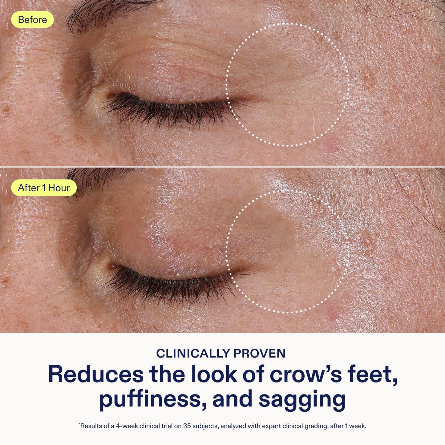 Skinfix Triple Lipid Eye Treatment - 0.5 fl oz - Eye Cream - Visibly Tightens, Depuffs & Smooths Undereyes - Non-Comedogenic - Fragrance Free - Vegan, Cruelty Free